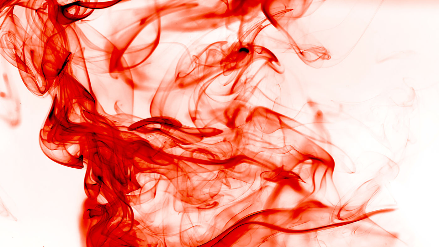 Real-world data backs potential of serum neurofilament light chain (sNFL)  as biomarkers for multiple sclerosis